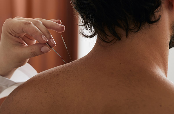 Los Angeles Acupuncture